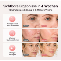 XSSNVV LED Gesichtsmaske Lichttherapie 4 Modi Rotlicht 850nm